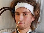 Teen denied life-saving transplant because he smoked pot