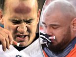 Craze for huffing smelling salts sweeps NFL sidelines