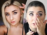 YouTuber Hannah Forcier reveals how her hair fell out