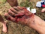 Queensland father shares images of son's motorbike injury