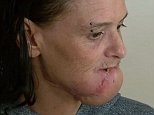 Adelaide woman mauled in the street by neighbour's dog