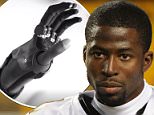 Mohamed Massaquoi reveals his hand was amputated